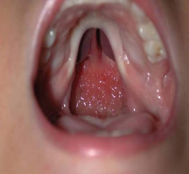 66cd84d3321b41c4.jpg