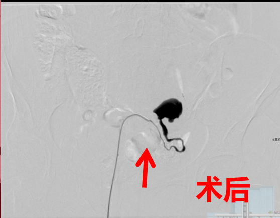 a072733e3f894b50.png