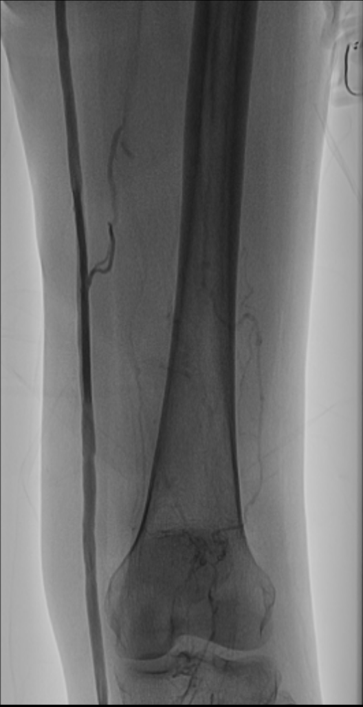 aea0320deb379cb4.png
