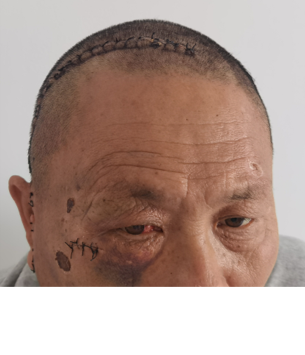 b08d6a328f60f030.png